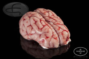 Cervells